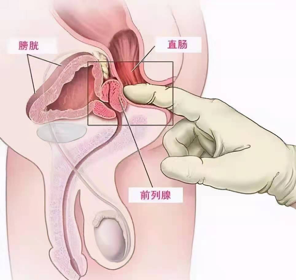 尿潴留最新研究及治疗进展综述